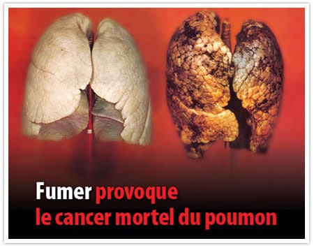 dangers du tabac
